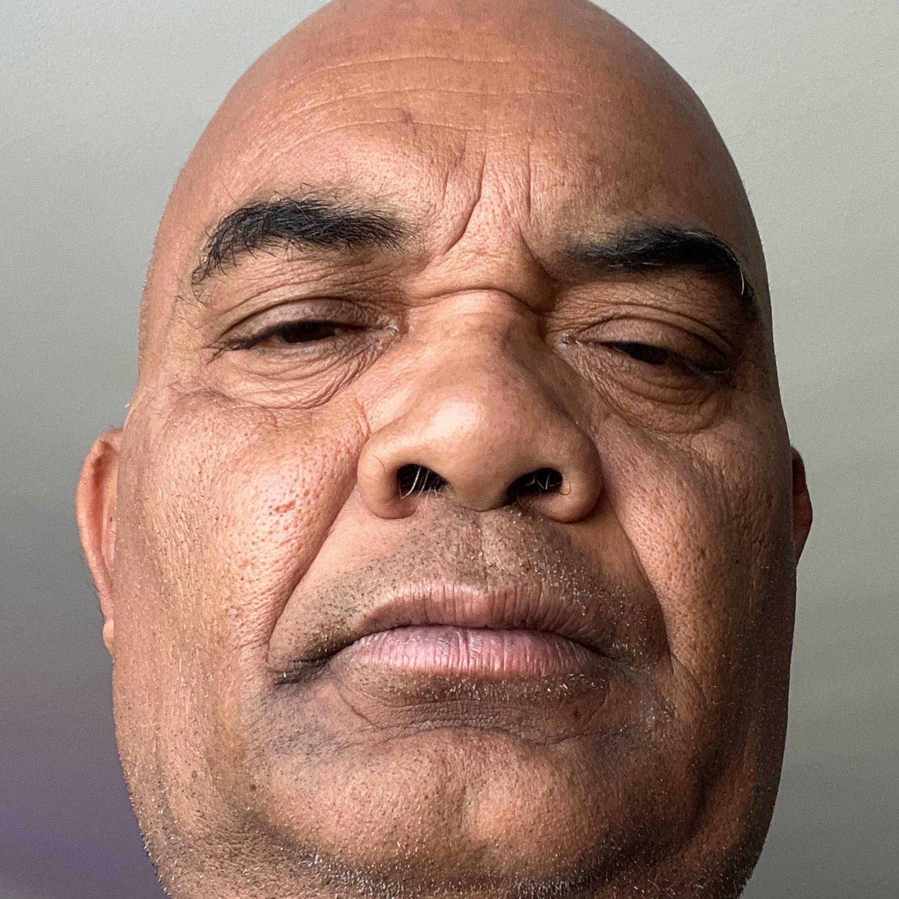 Elson Mudong