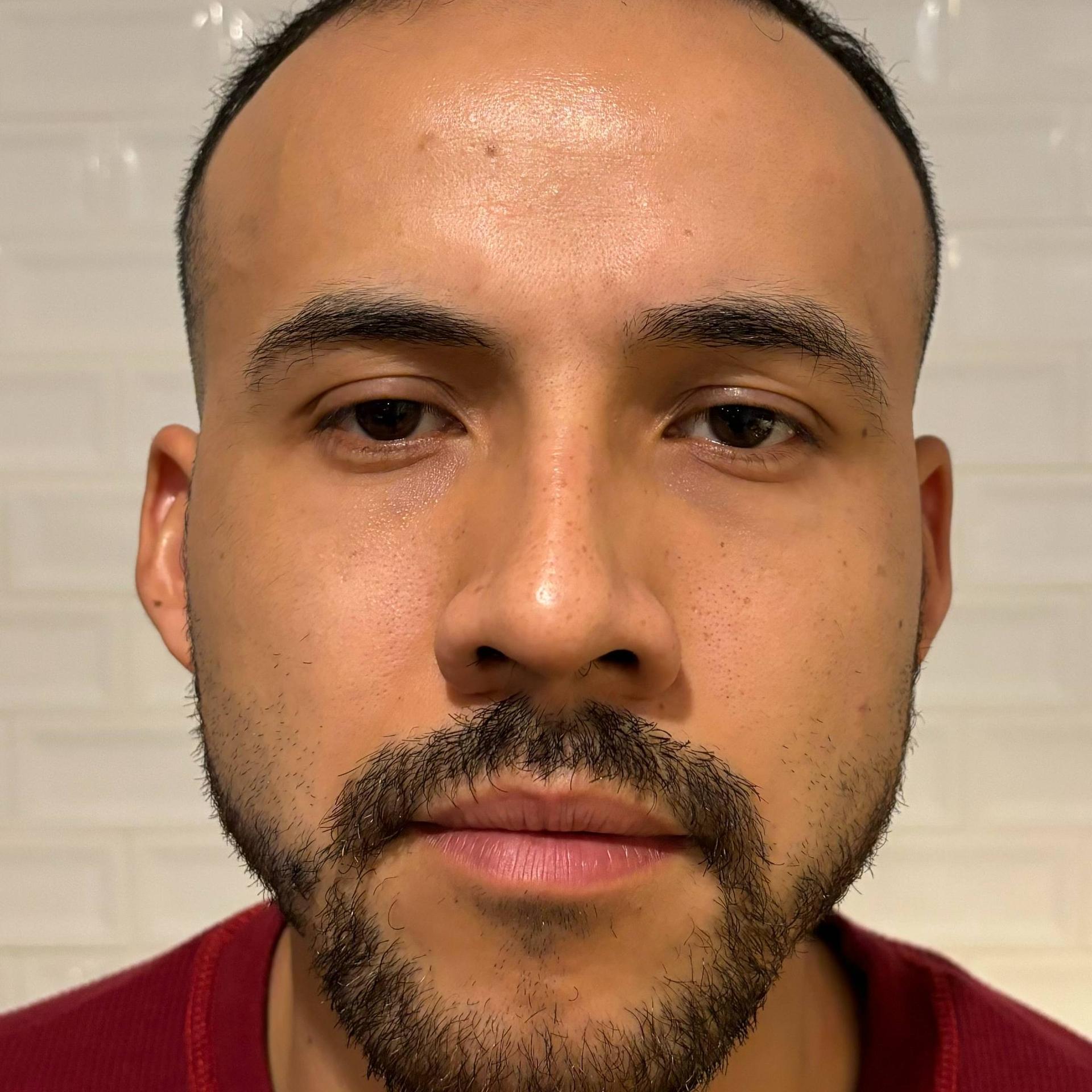 Anthony Alvarez