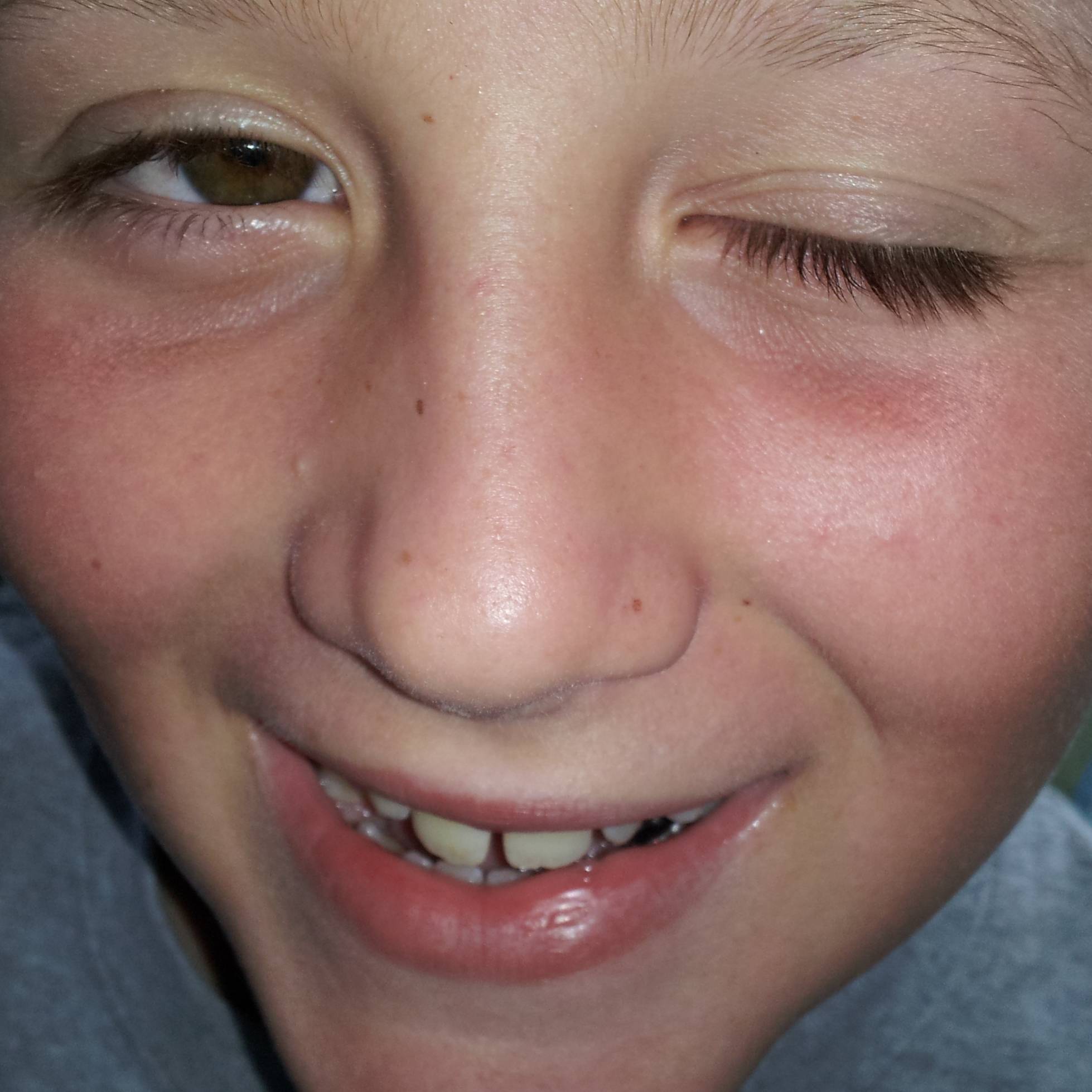 Trent Johnson