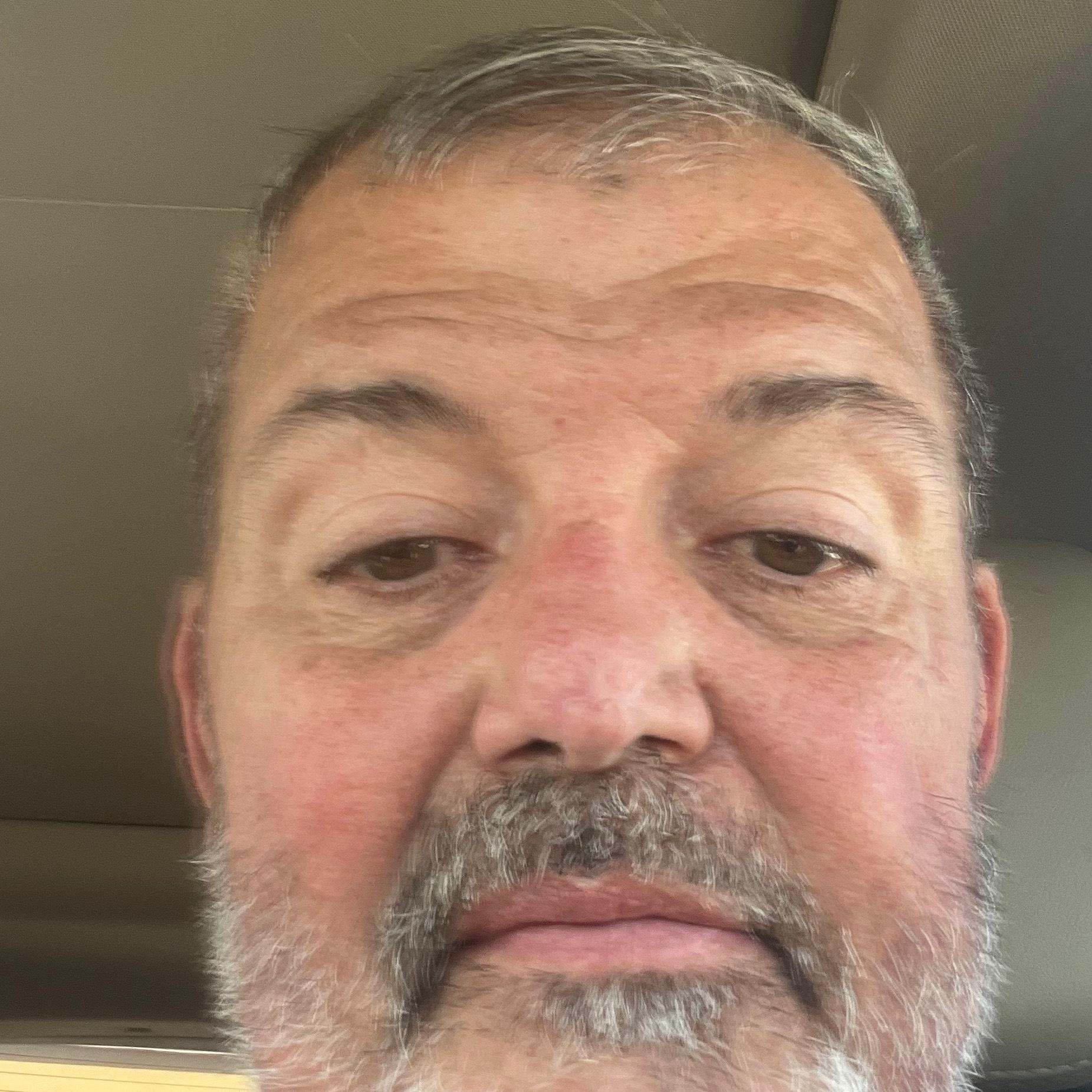 Gary Urich