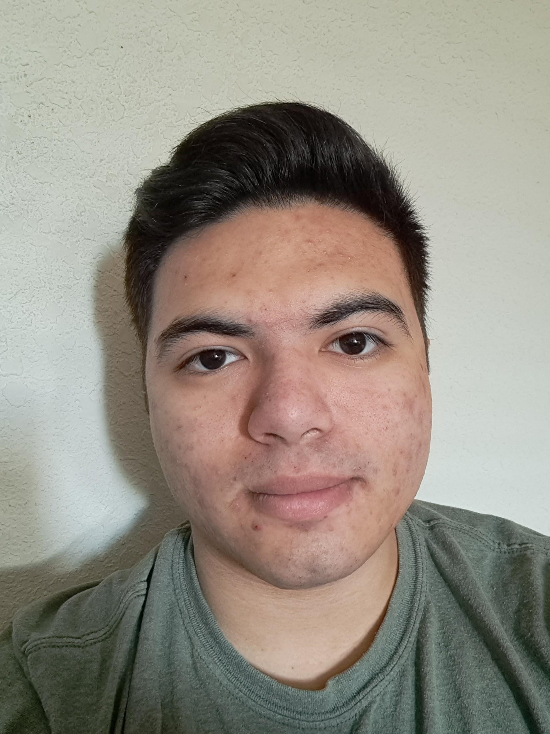 Diego Elias Hernández