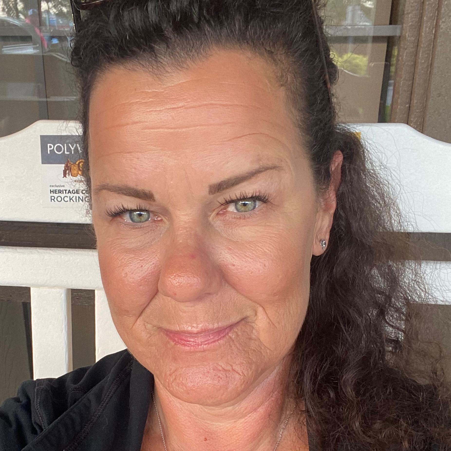 Lora Ellingson