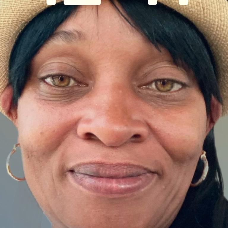 Toni Dyous