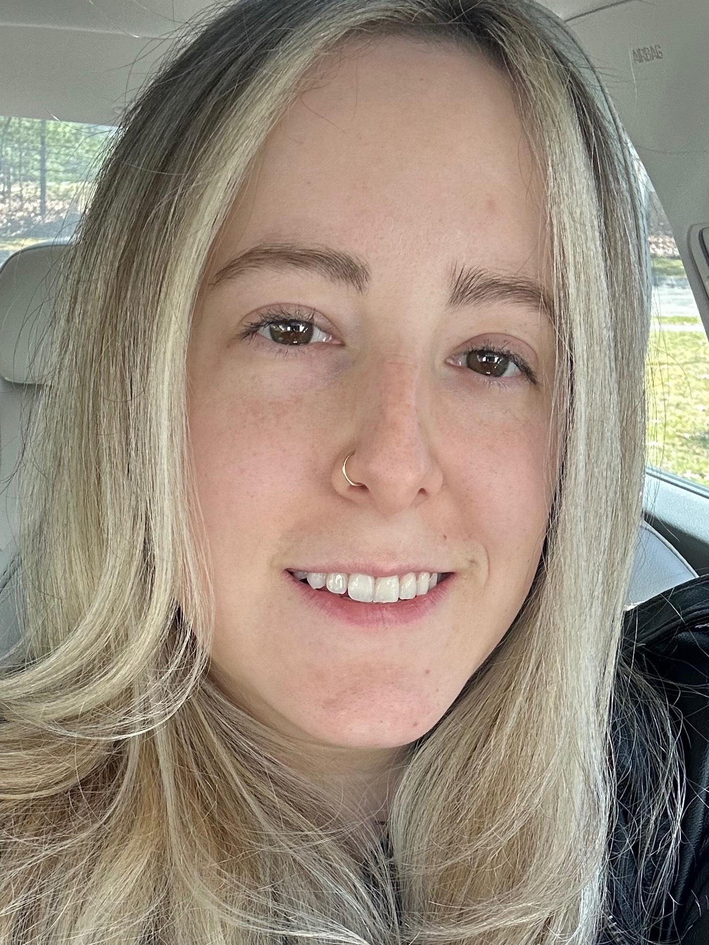 Allison Fischer