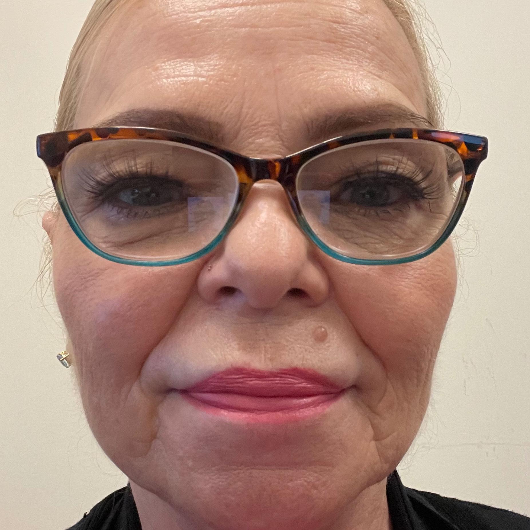 Patricia Teske