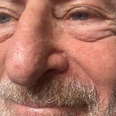 STEVEN ALPERT
