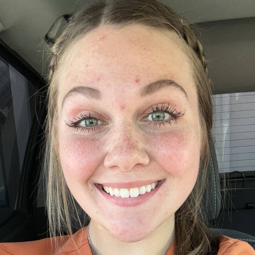 Hailey Franke